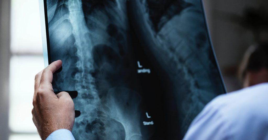 Key Questions to Ask During Your Initial Consultation