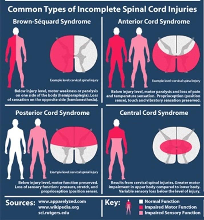 Identifying Liability and Pursuing Compensation